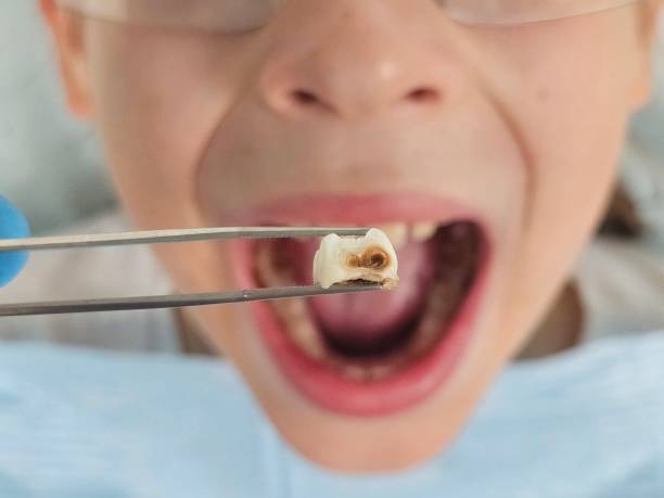 Best Emergency Dental Services for Seniors in Bay Point, CA